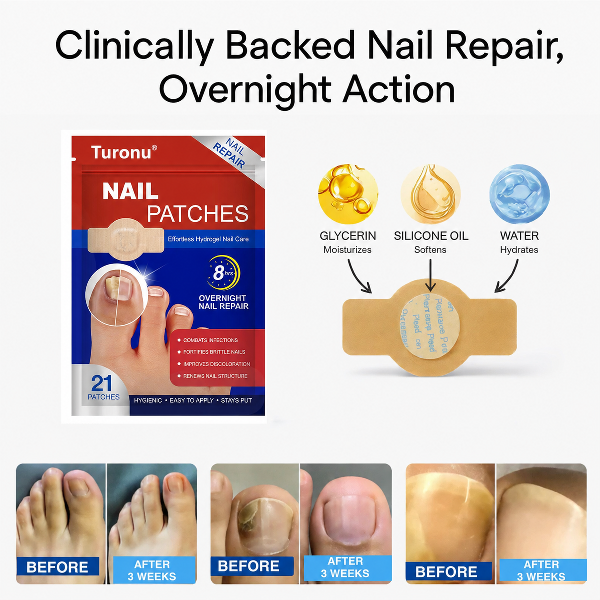 🔥🔥Turonu® Fungus Nail Repair Patches