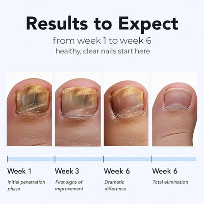 🔥🔥Turonu® Fungus Nail Repair Patches