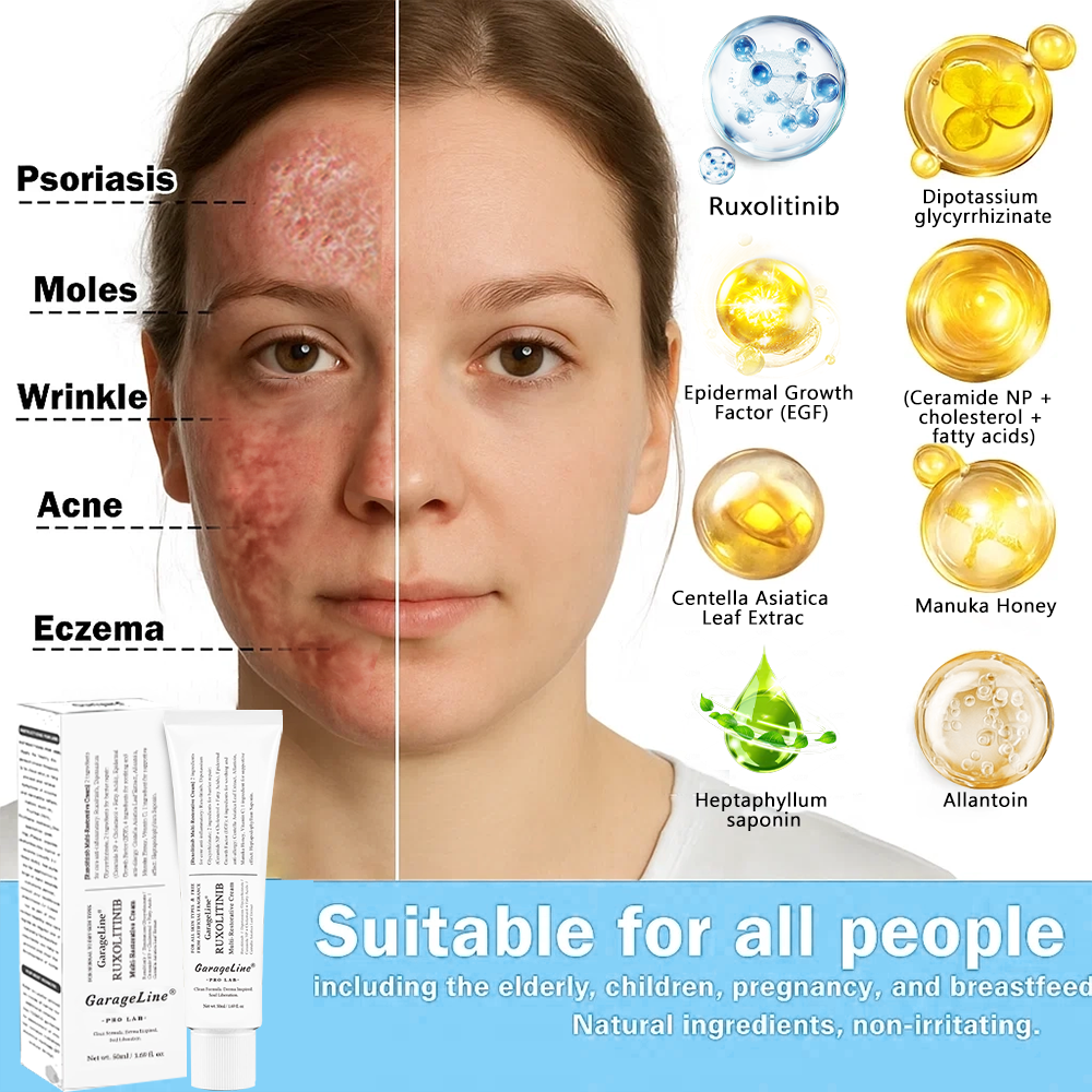 【GarageLine® Official Store】JAK-Smart Ruxolitinib Repair Complex 🏥（Zero Inflammation, 72H Sustained Release | Acne Clear in 10 Days | 97.7% Redness Reduction | Clinically Tested）