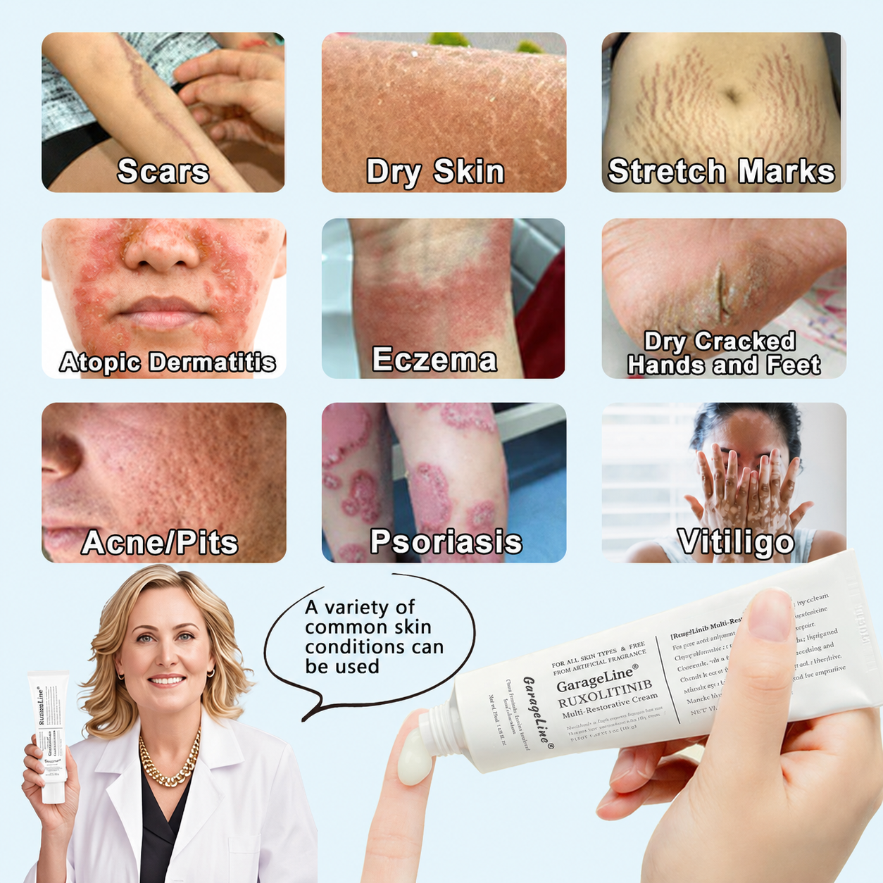 【GarageLine® Official Store】JAK-Smart Ruxolitinib Repair Complex 🏥（Zero Inflammation, 72H Sustained Release | Acne Clear in 10 Days | 97.7% Redness Reduction | Clinically Tested）